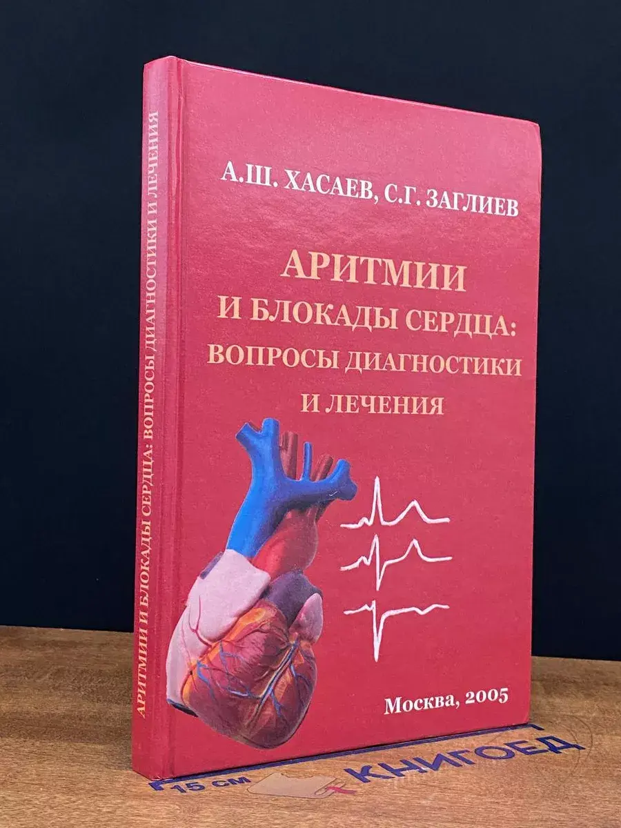 Аритмии и блокады сердца. Вопросы диагностики и лечения