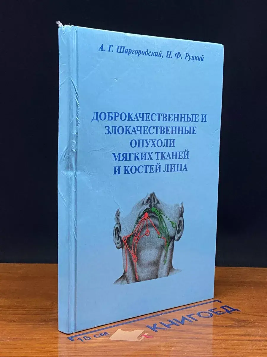 Доброкачественные и злокачественные опухоли мягких тканей